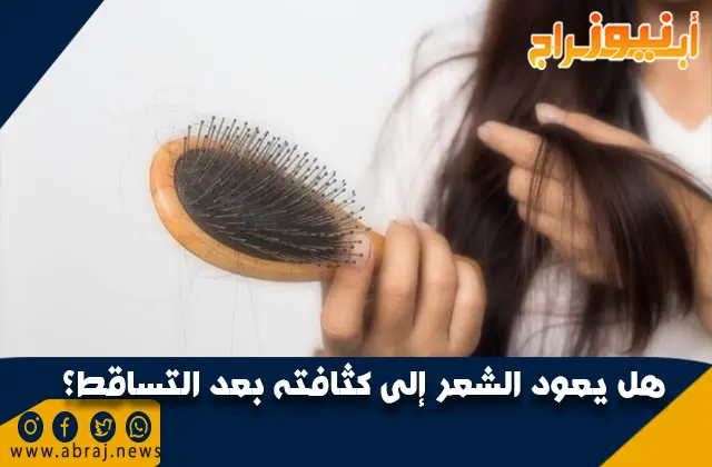 علاج تساقط الشعر - هل يعود الشعر إلى كثافته بعد التساقط؟