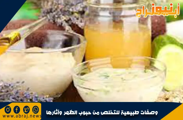 وصفات طبيعية للتخلص من حبوب الظهر وآثارها .. طب الأعشاب التقليدي