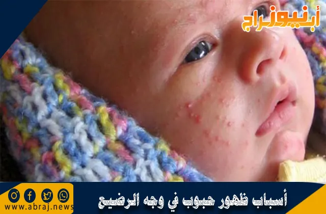 أسباب ظهور حبوب في وجه الرضيع ونصائح لعلاجها