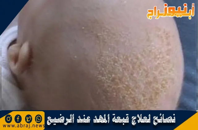 نصائح لعلاج قبعة المهد عند الرضيع (خبز الرأس)