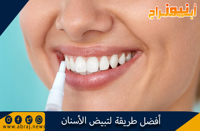 أفضل طريقة لتبيض الأسنان