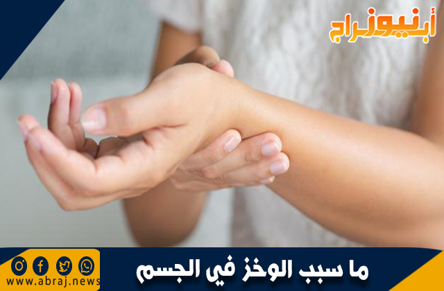 ما سبب الوخز في الجسم