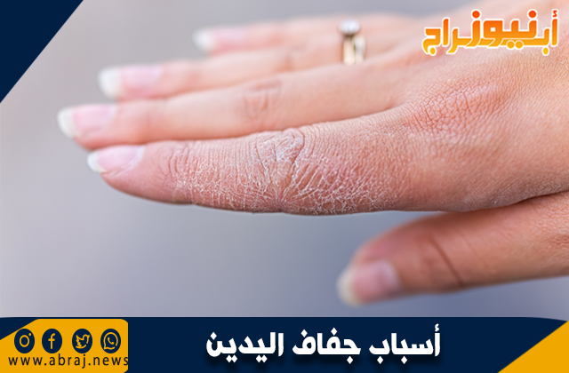 أسباب جفاف اليدين