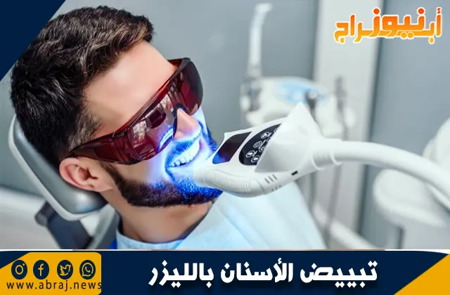 تبييض الأسنان بالليزر