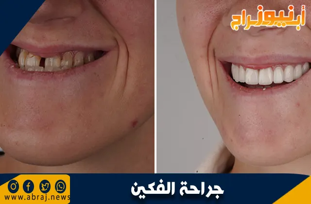 جراحة الفكين