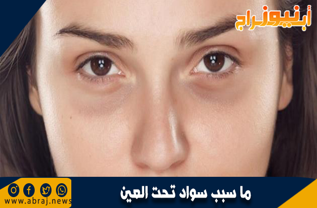 ما سبب سواد تحت العين