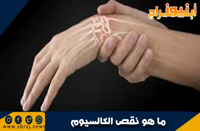 ما هو نقص الكالسيوم؟ الأسباب والأعراض والعلاج