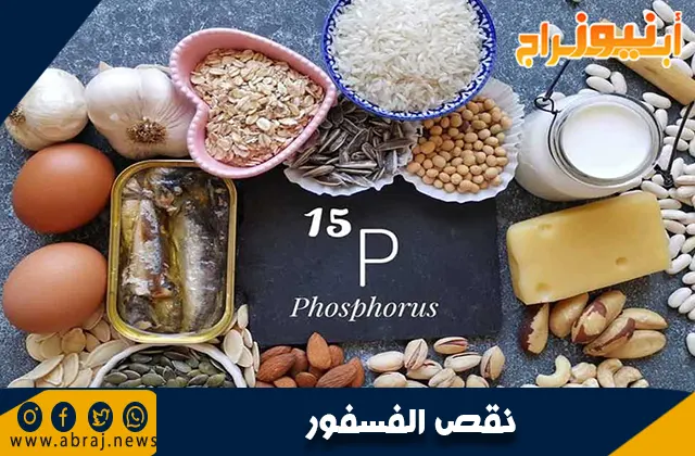 ما هو نقص الفسفور؟ الأسباب والأعراض والعلاج