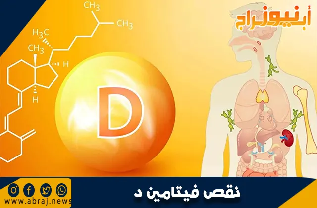 نقص فيتامين د: الأسباب والأعراض والعلاج