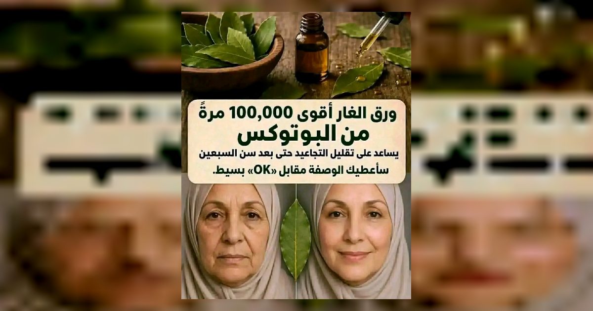 أوراق الغار أقوى بـ 100,000 مرة من البوتوكس. فهي تزيل التجاعيد حتى في سن السبعين.