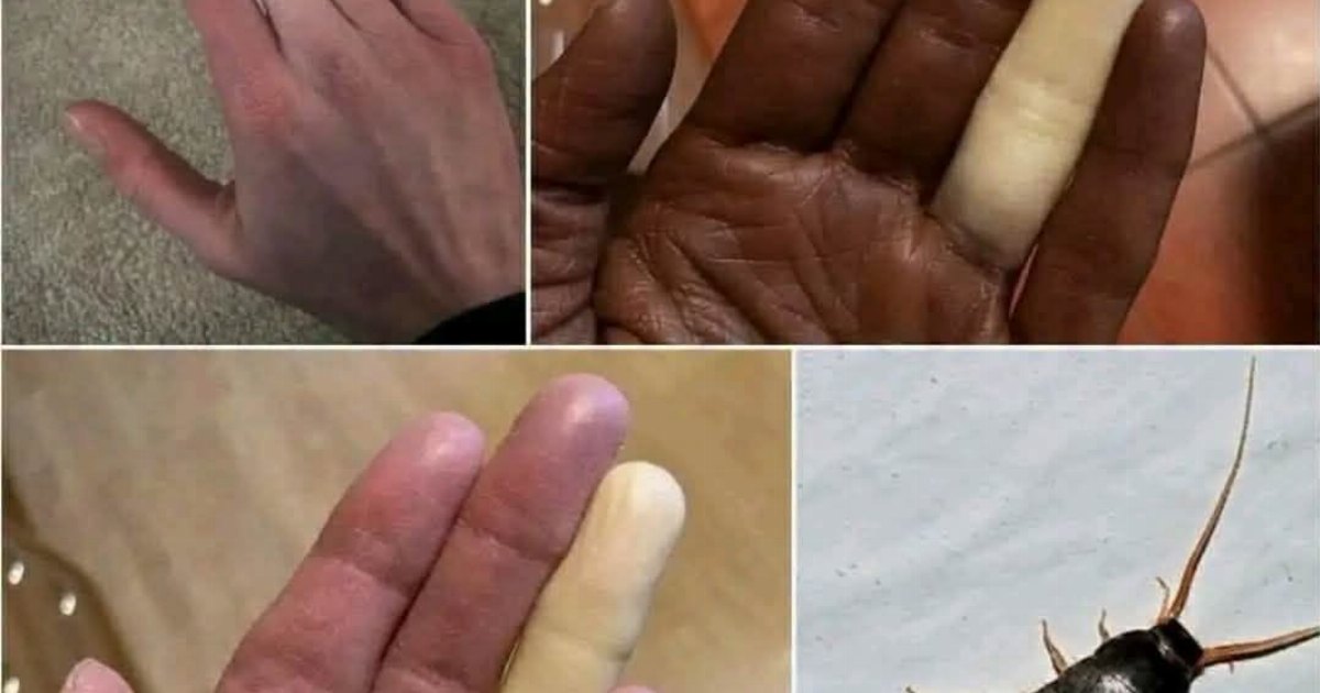 احذر مليون مرة قبل ملامسة هذه الحشـ.