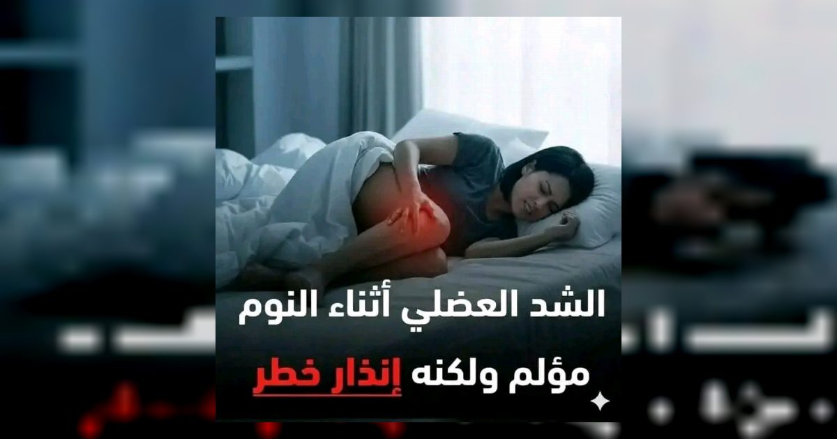 الشد العضلي