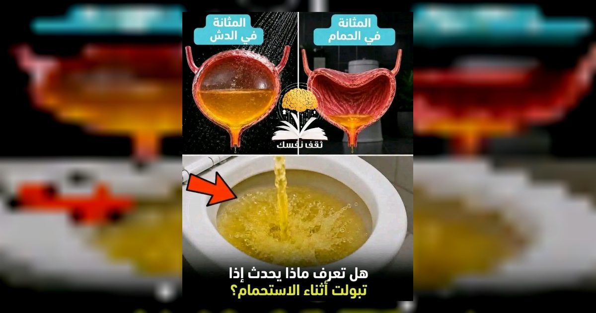 اضرار التبول واقفا