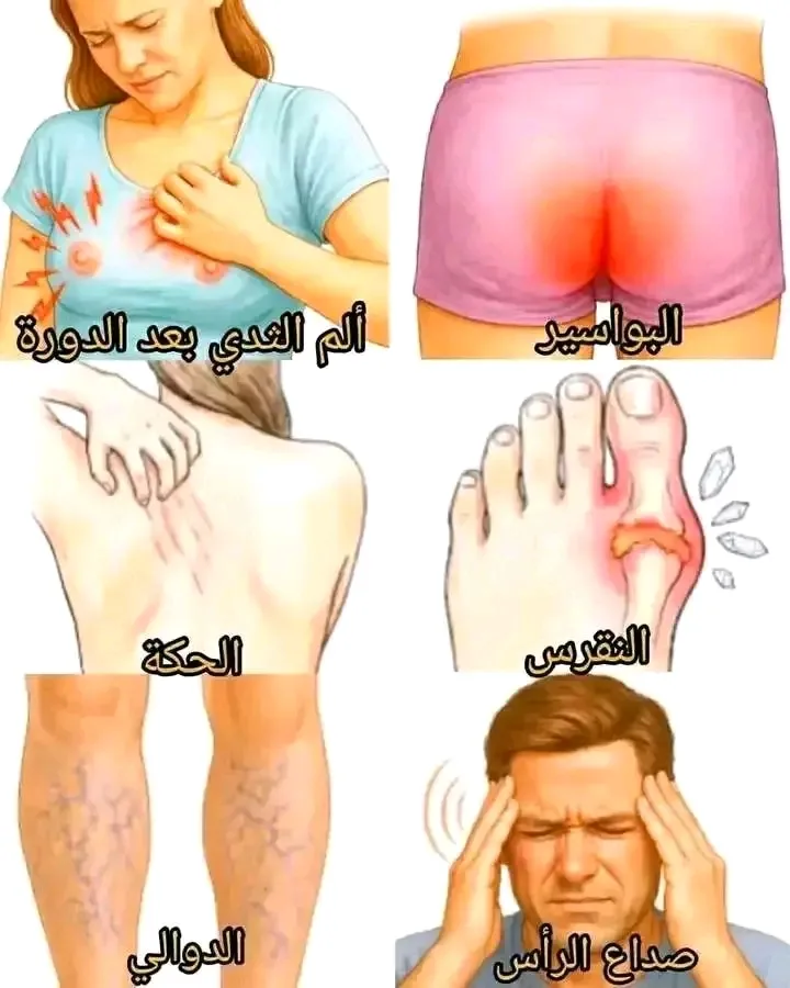 البواسير