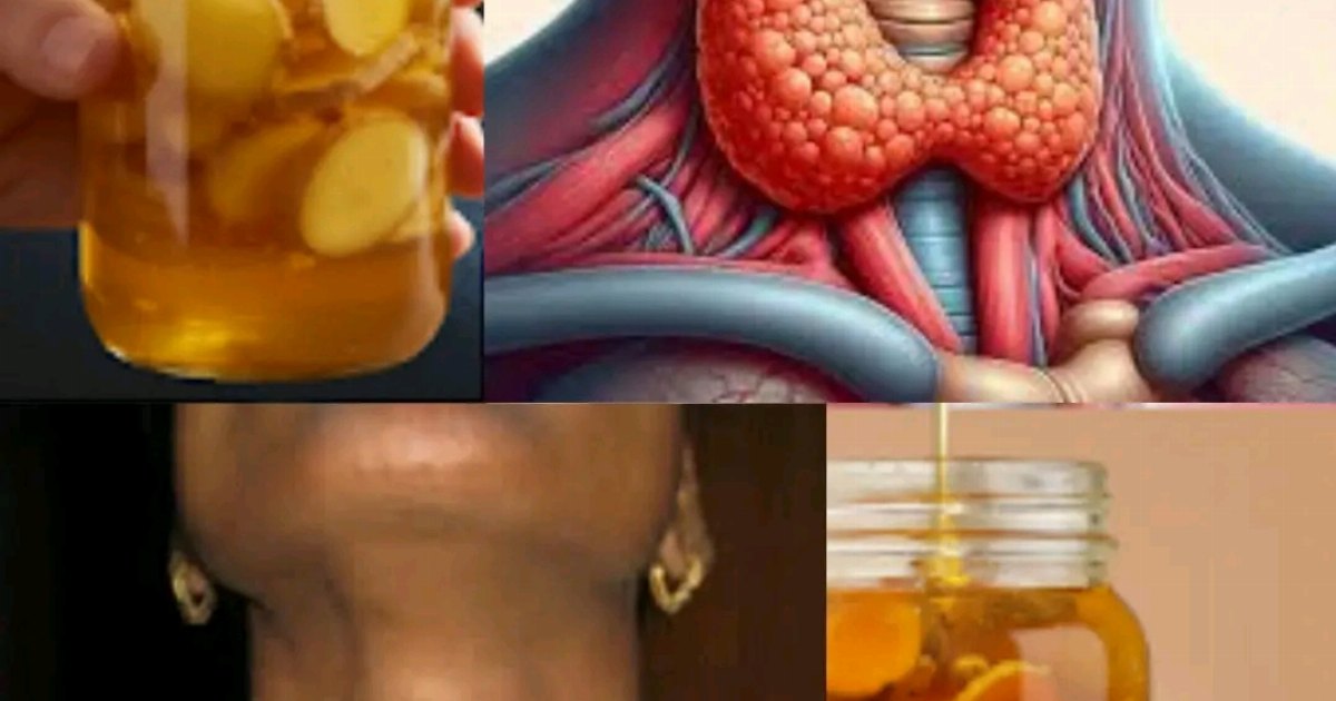 بلغو مرضى الغدة