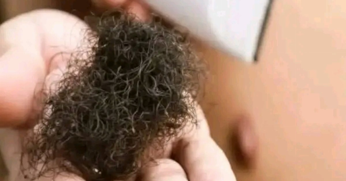 اسعار الذهب