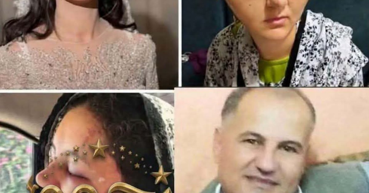 لا حول ولا قوة إلا بالله! الأب بهدل بنته وهي لسا عروسة بالشكل دا بسبب.. عرض المزيد
