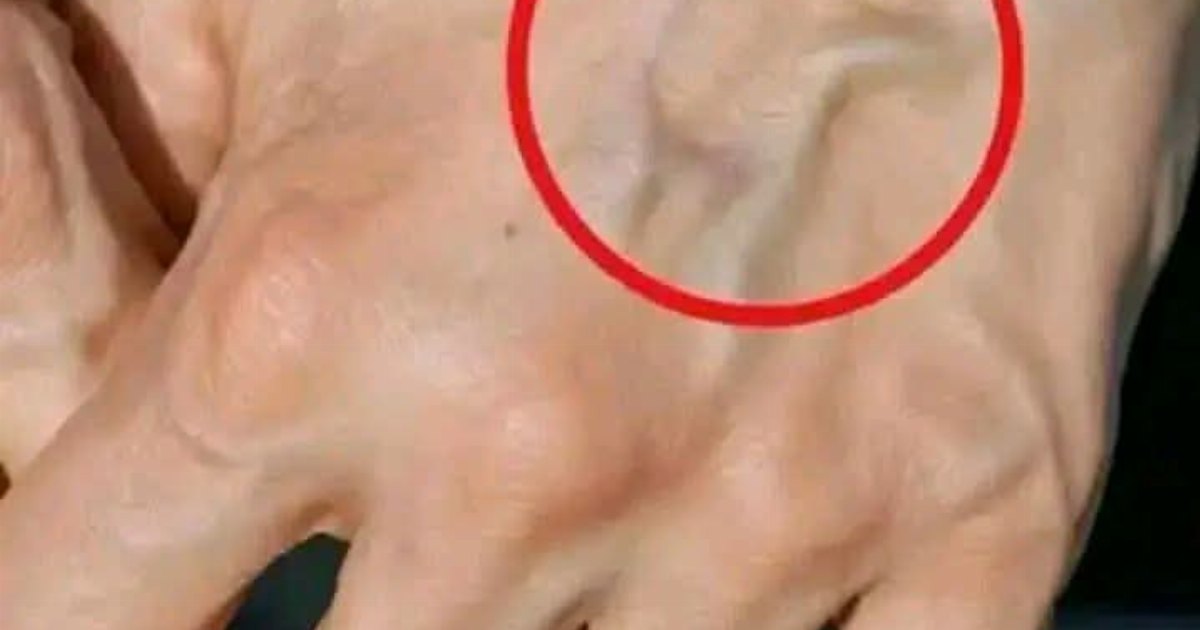 إذا كانت عـ.ـروقك بارزة سواء كنت صغير او كبير في السن ، فهذا يعني أنك..عرض المزيد