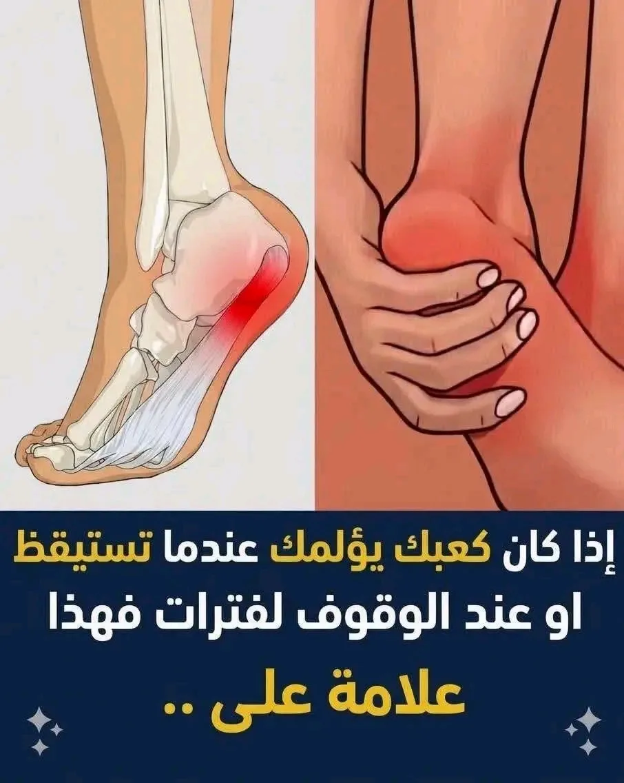 اسبـ.ـاب الـ.ـم كعب القدم عند الاستيقاظ او عند الوقوف لفترات طويلة ..