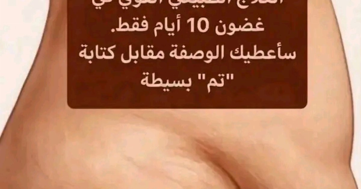 البطن المترهل