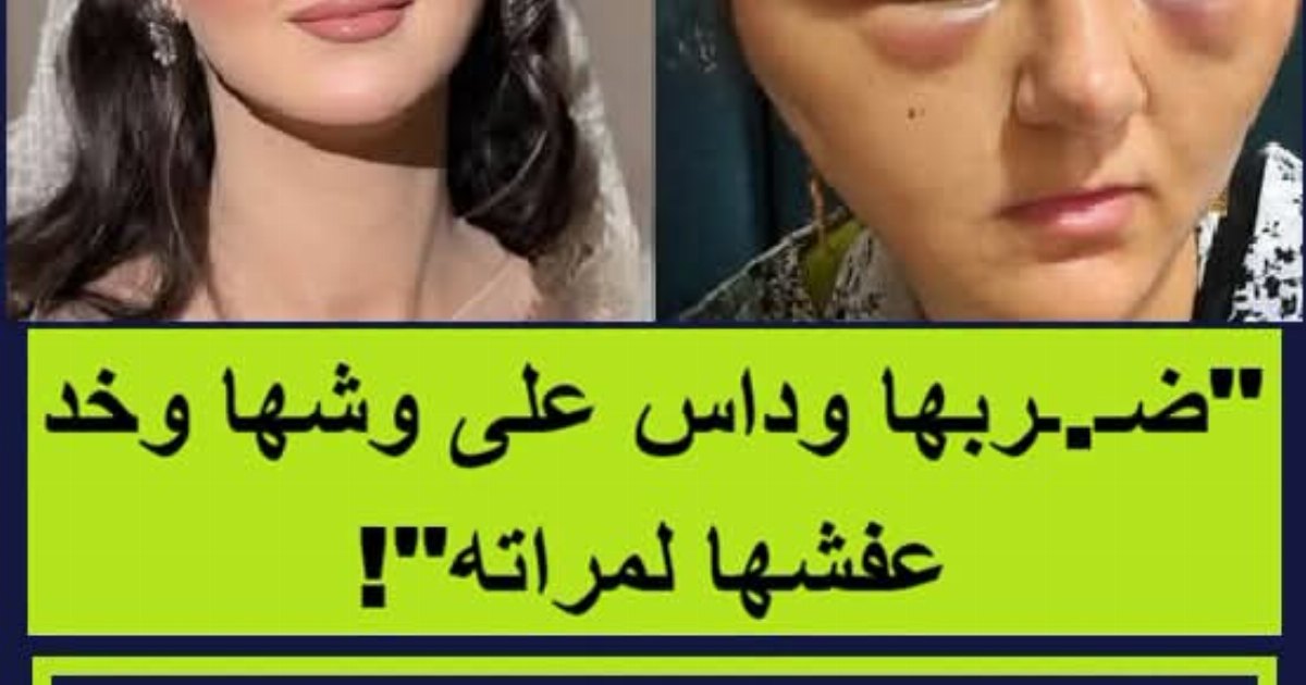 🚨 "سحـ ،ـلها وداس على وشها وخد عفشها لمراته"! 😱💥 جريـ ،ـمة قـ ،ـسوة أسرية تقشـ ،ـعر لها الأبدان بالدقهلية: فتاة تتـ ،ـهم والدها بالاعتـ ،ـداء الصـ ،ـادم عليه