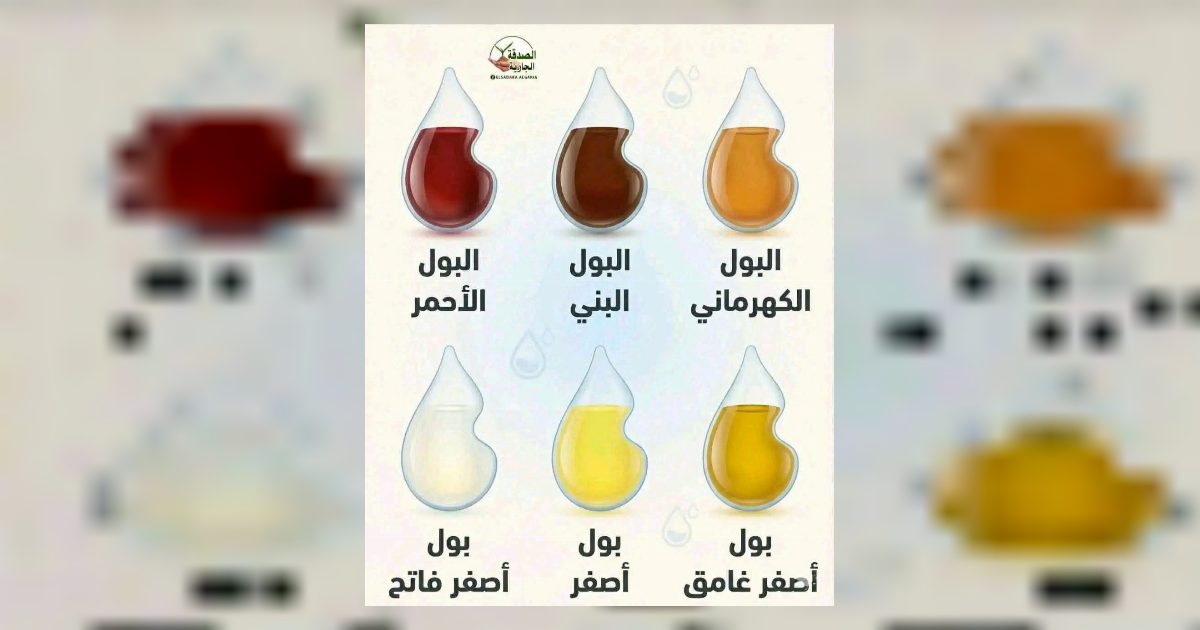 ● البول الأحمر = جفاف حاد ● البول البني