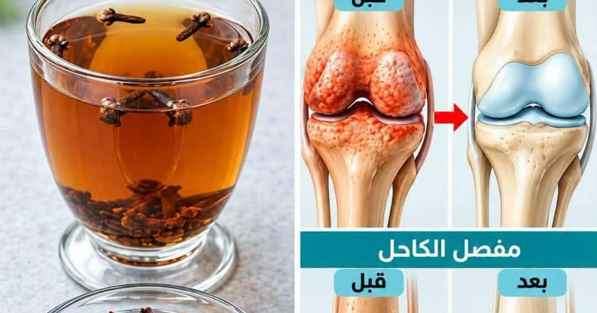 فـ.ـوائد القرنفل واستخدامات مشـ.ـروب القرنفل لتقـ.ـوية العظـ.ـام وتسكـ.ـين الم المفـ.ـاصل وطـ.ـريقة التحضيـ.ـر