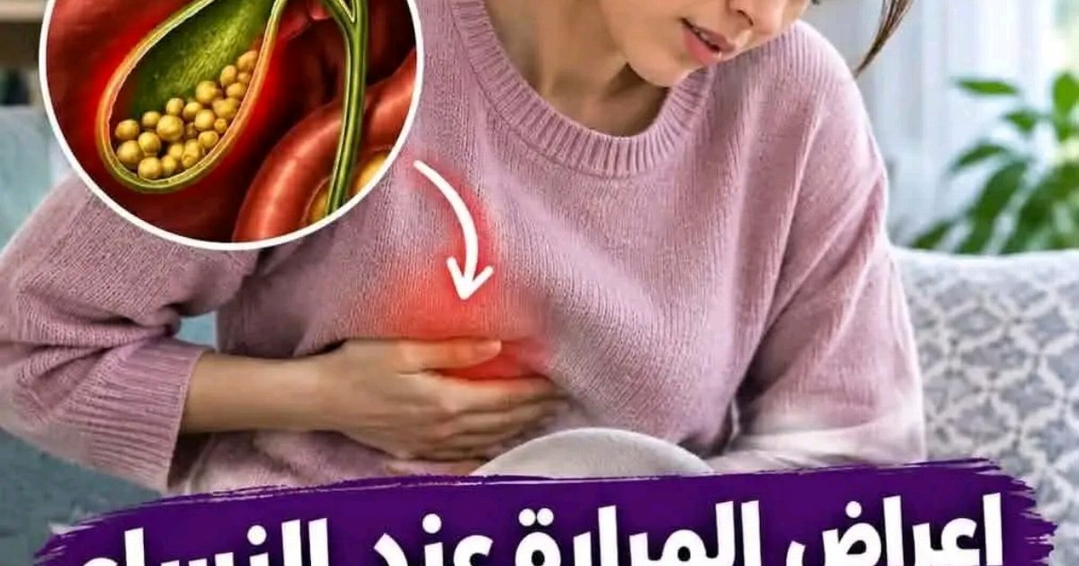اعراض المراره