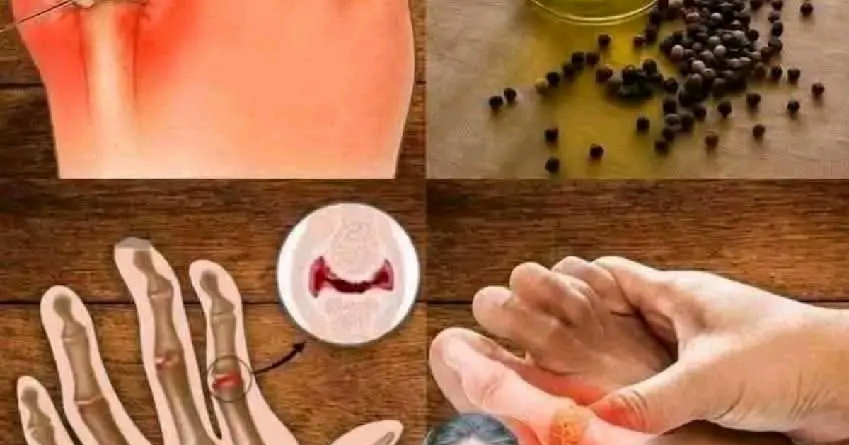 زيت يقضي على اليورك اسيد