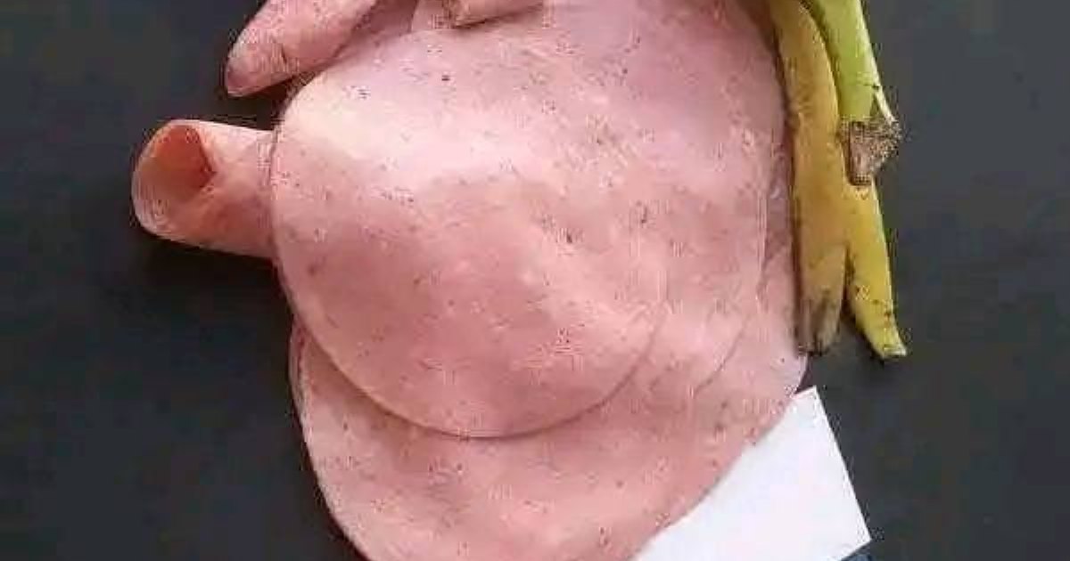 يشبه واحد نعرفوا وما بنحبوا