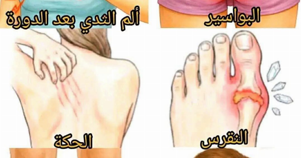 🔴 البو.اسير ✅ الأسباب المحتملة 1- الإمسا.ك المستمر والشدّ أثناء الإخر.اج….عرض المزيد