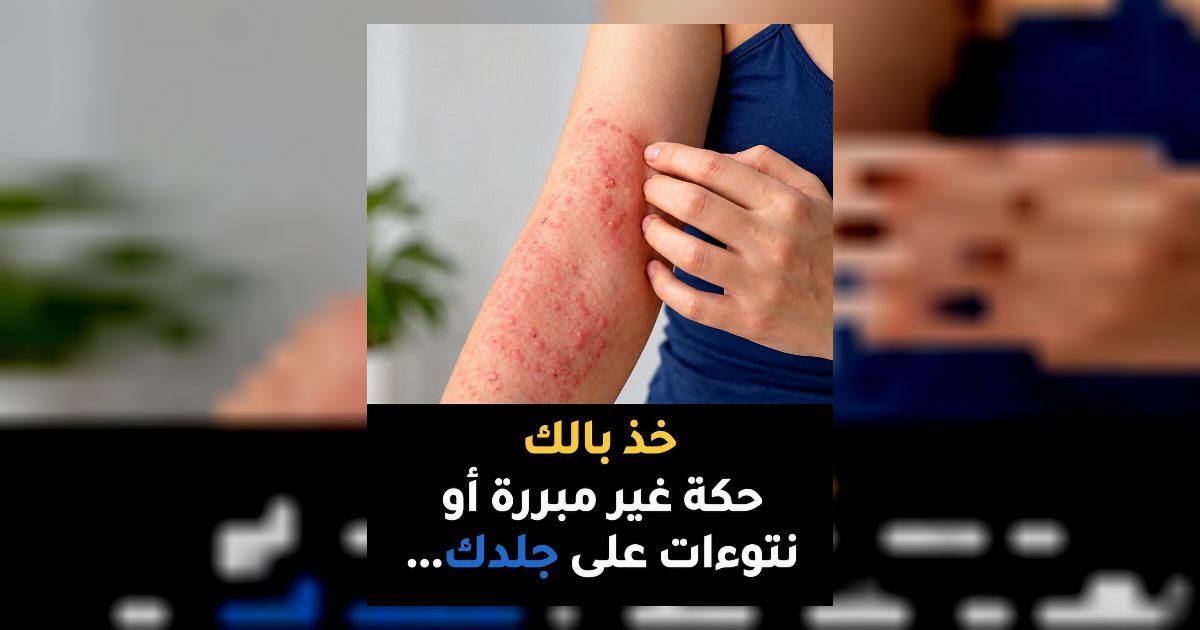 انتبه عـ.ـلامات تحـ.ـذيرية على الجسـ.ـم لا تتجاهلها منها حكة الجلد تدل على إصـ.ـابة بعض أعضاء الجسـ.ـم بالأمـ.ـراض اسبـ.ـابها وطـ.ـرق عـ.ـلاجها التفـ.ـاصيل مقـ.