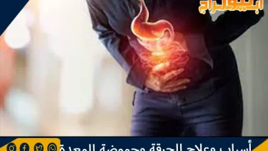 أسباب وعلاج الحرقة وحموضة المعدة وأهم النصائح