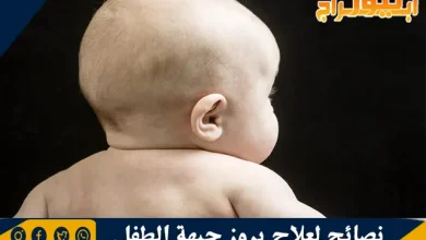 نصائح لعلاج بروز جبهة الطفل