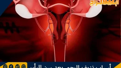 أسباب نزيف الرحم بعد سن اليأس ونصائح لعلاجه