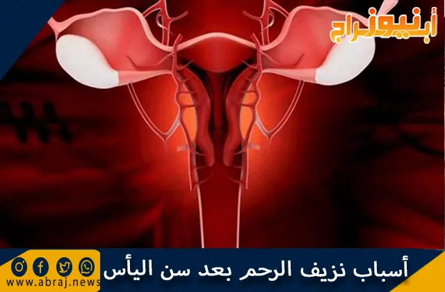 أسباب نزيف الرحم بعد سن اليأس ونصائح لعلاجه