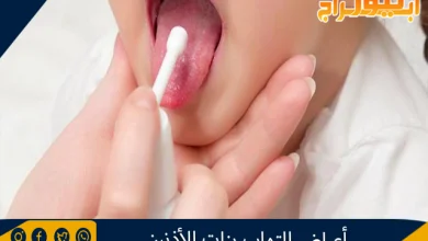 أعراض التهاب بنات الأذنين