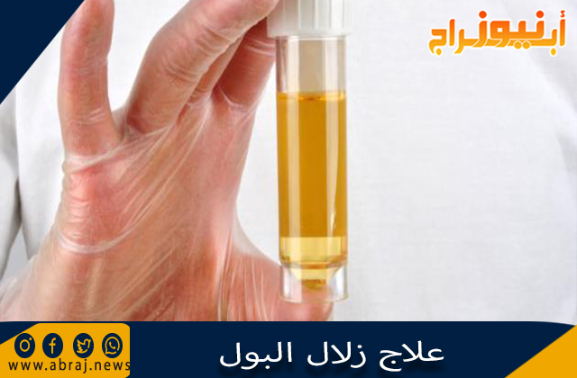 علاج زلال البول